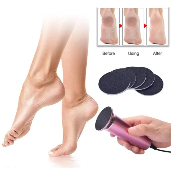 Pulidor de Callos Eléctrico Zo – ¡Transforma tus pies en minutos!